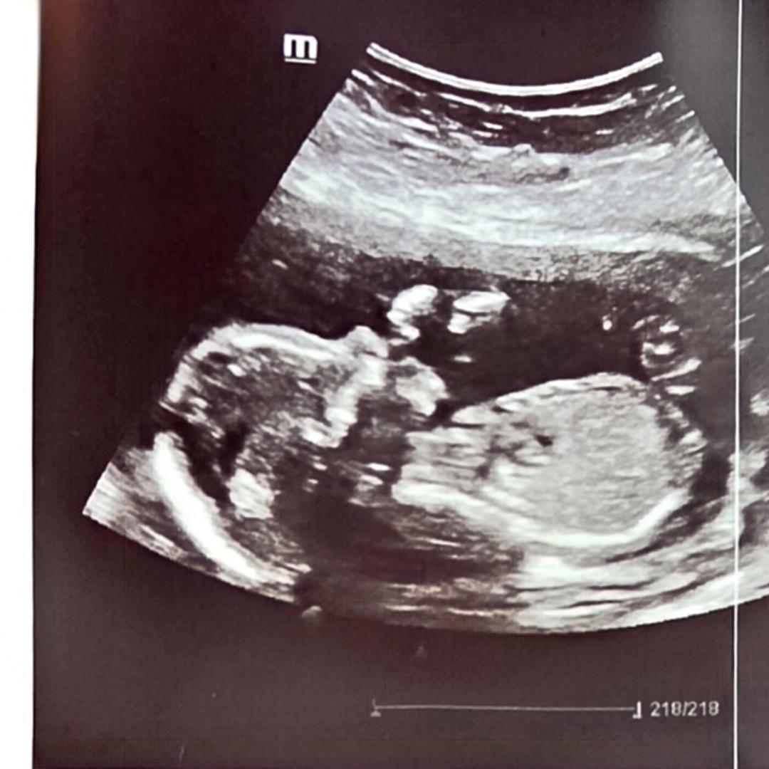 Photo shared by Mayra for their Babylist baby registry.