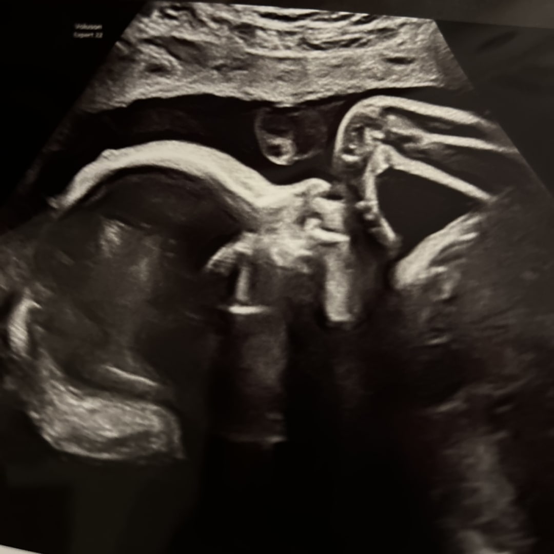 Photo shared by Courtney for their Babylist baby registry.