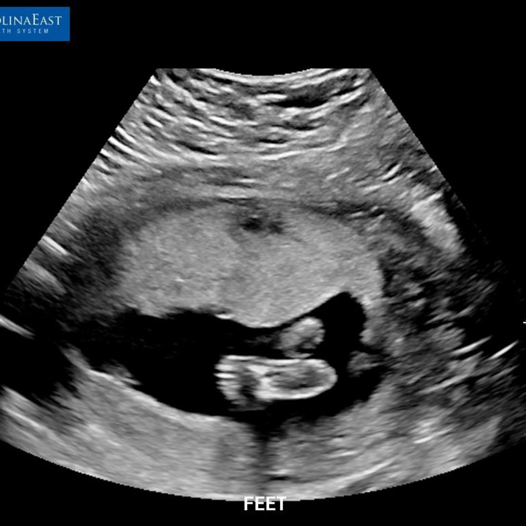 Photo shared by Sarah for their Babylist baby registry.