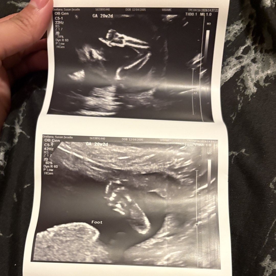 Photo shared by Susan for their Babylist baby registry.