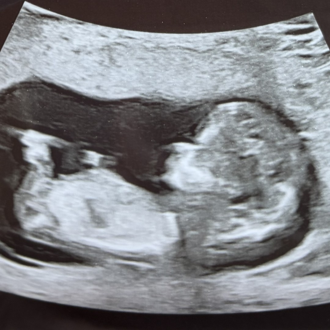 Photo shared by Carlina for their Babylist baby registry.