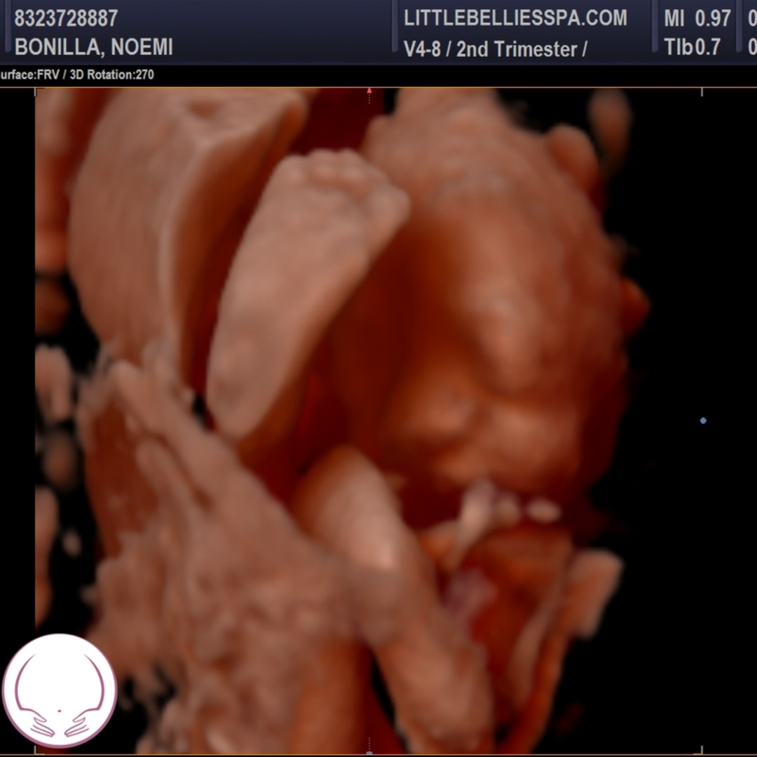 Photo shared by Noemi for their Babylist baby registry.