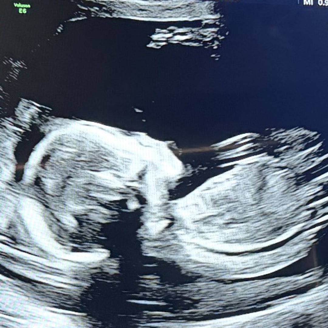 Photo shared by Holly for their Babylist baby registry.