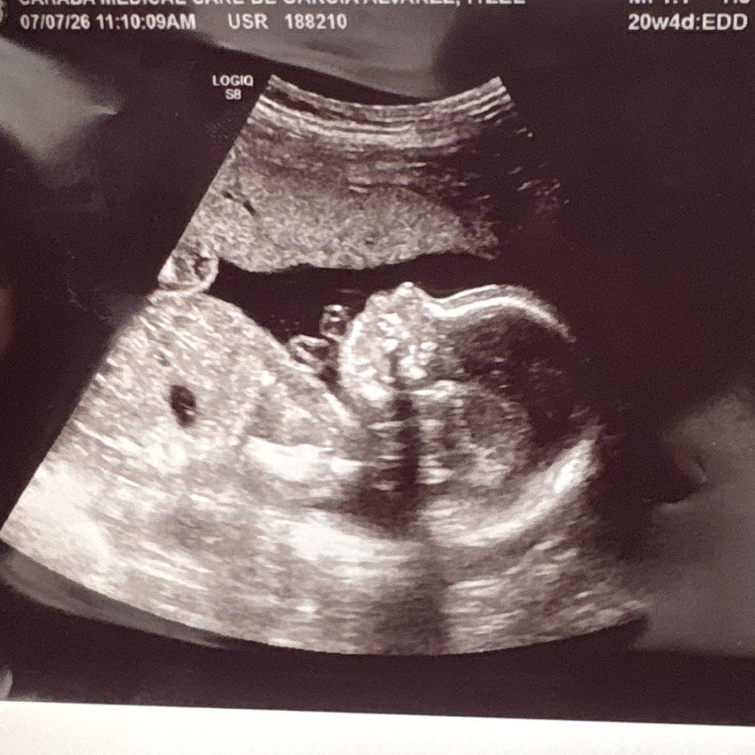 Photo shared by Itzel for their Babylist baby registry.