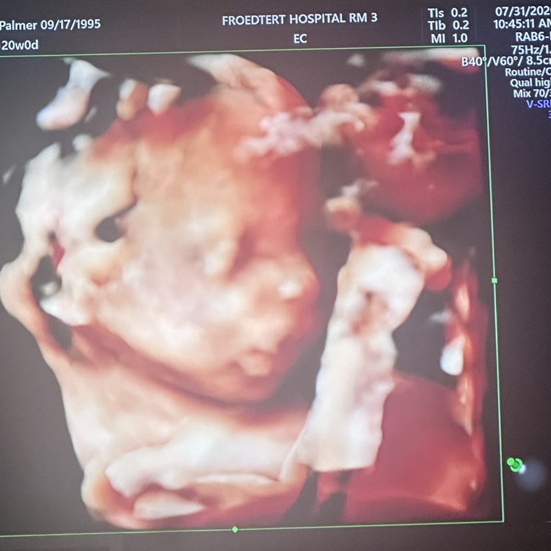 Photo shared by Ellen and Tyler for their Babylist baby registry.