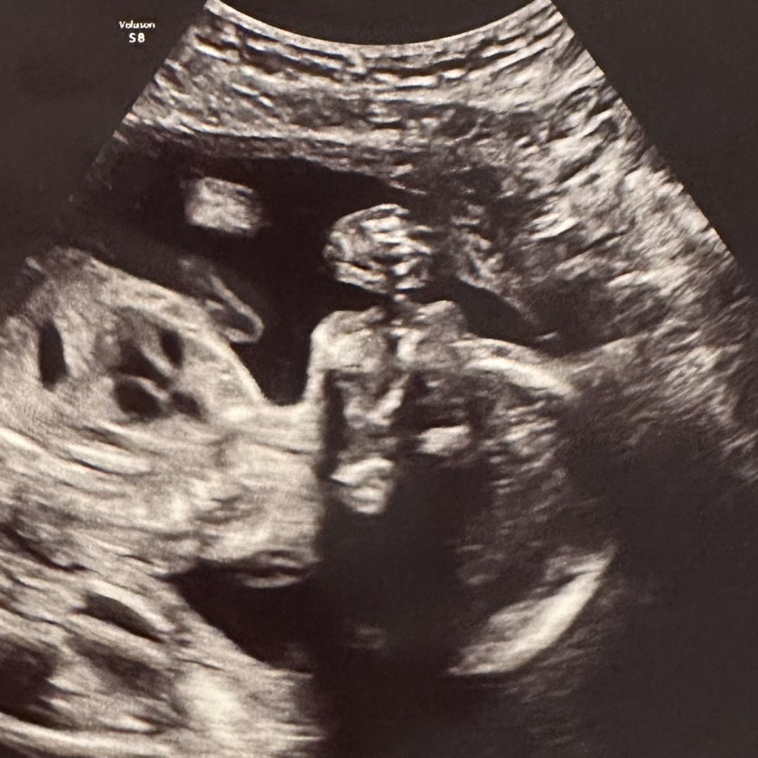 Photo shared by Abbi for their Babylist baby registry.