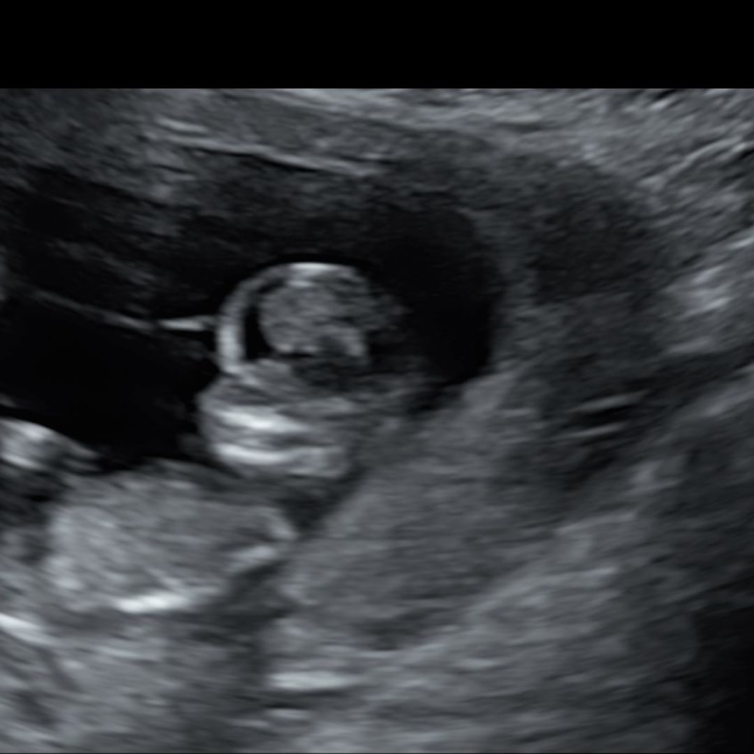 Photo shared by Paige for their Babylist baby registry.