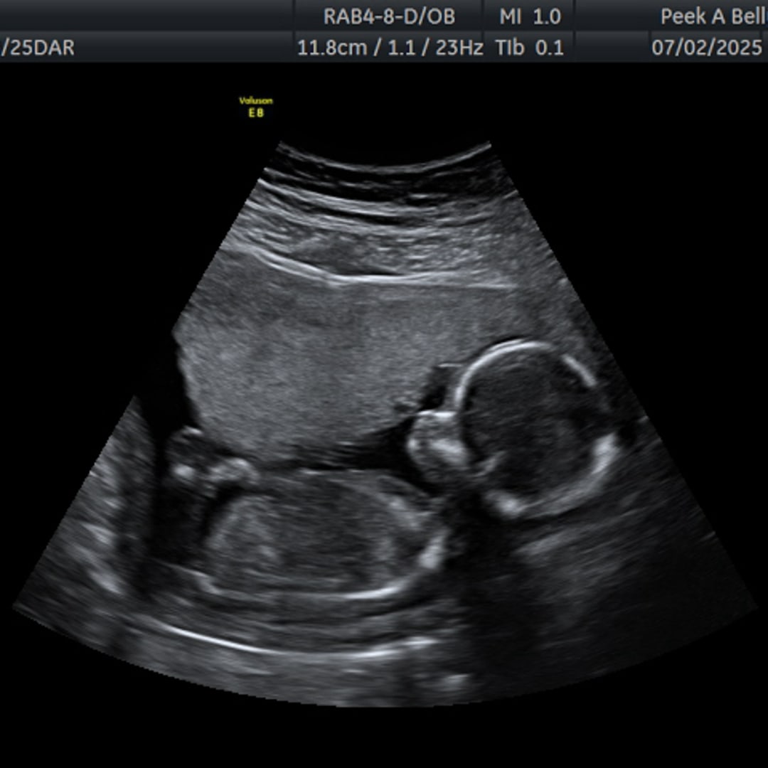 Photo shared by Daira for their Babylist baby registry.