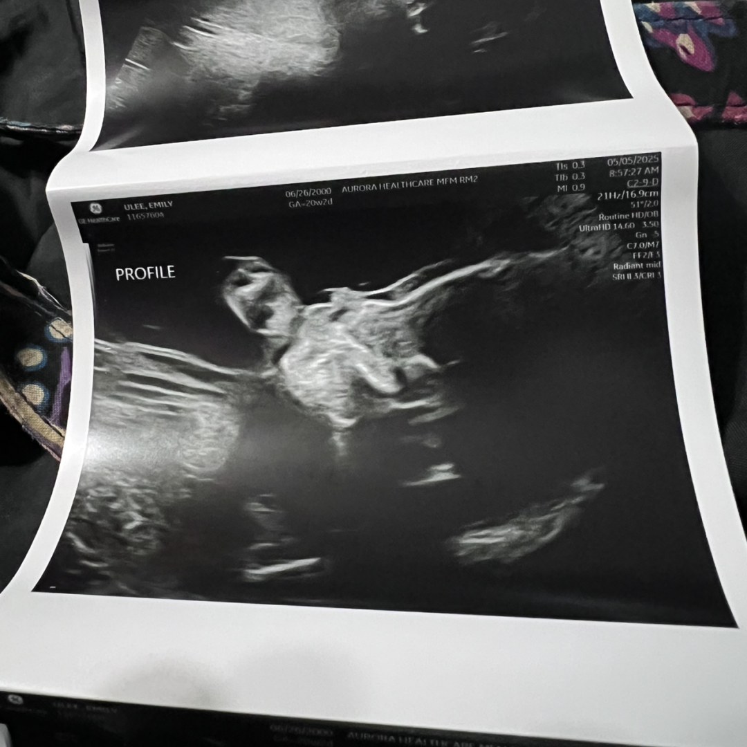 Photo shared by Emily for their Babylist baby registry.