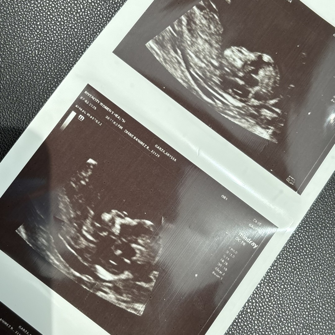 Photo shared by Ary for their Babylist baby registry.
