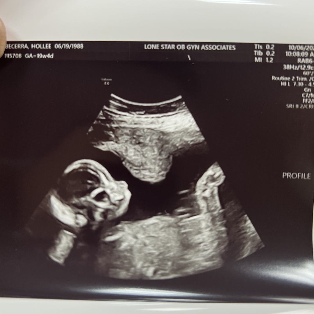 Photo shared by Hollee for their Babylist baby registry.