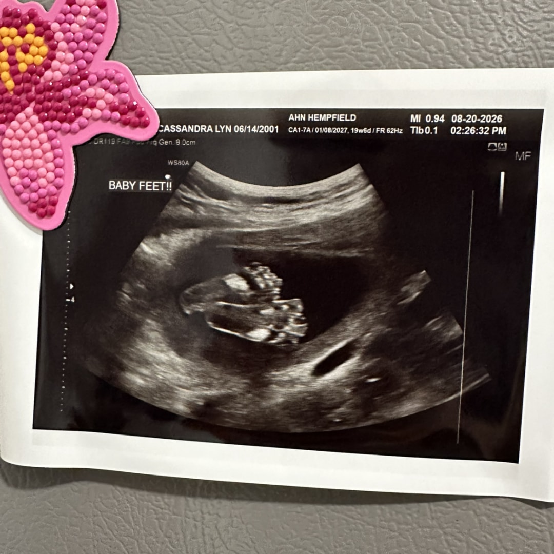 Photo shared by Cass for their Babylist baby registry.