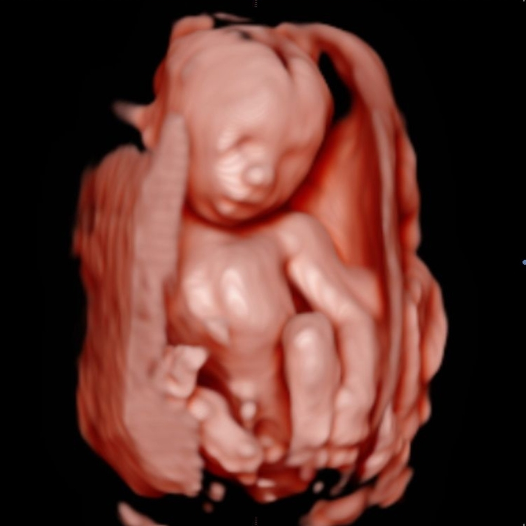 Photo shared by Erica for their Babylist baby registry.