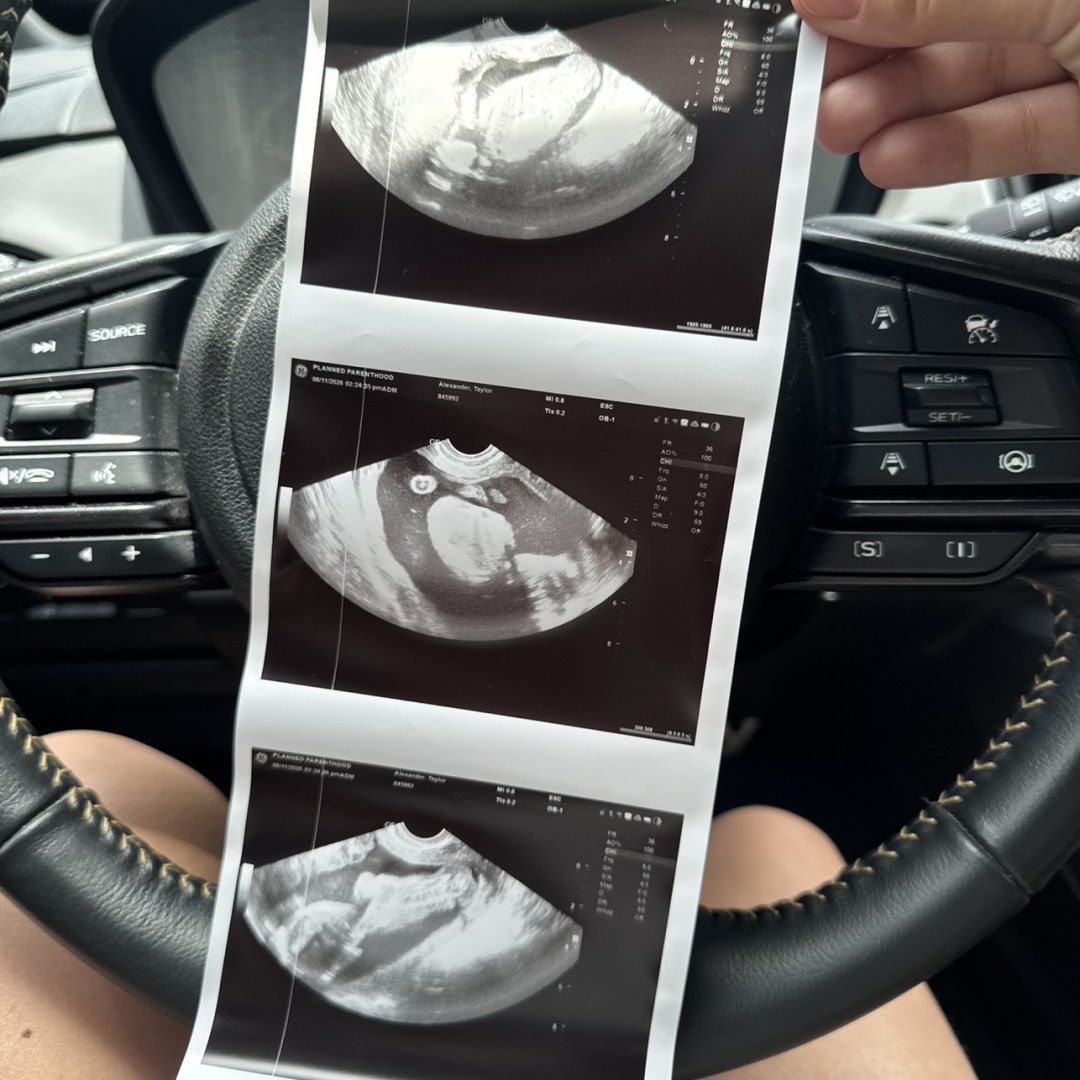 Photo shared by Taylor for their Babylist baby registry.