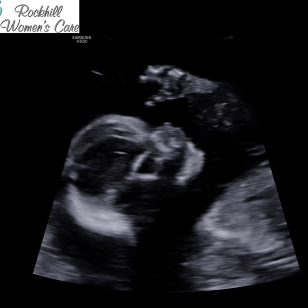 Photo shared by Kelli for their Babylist baby registry.