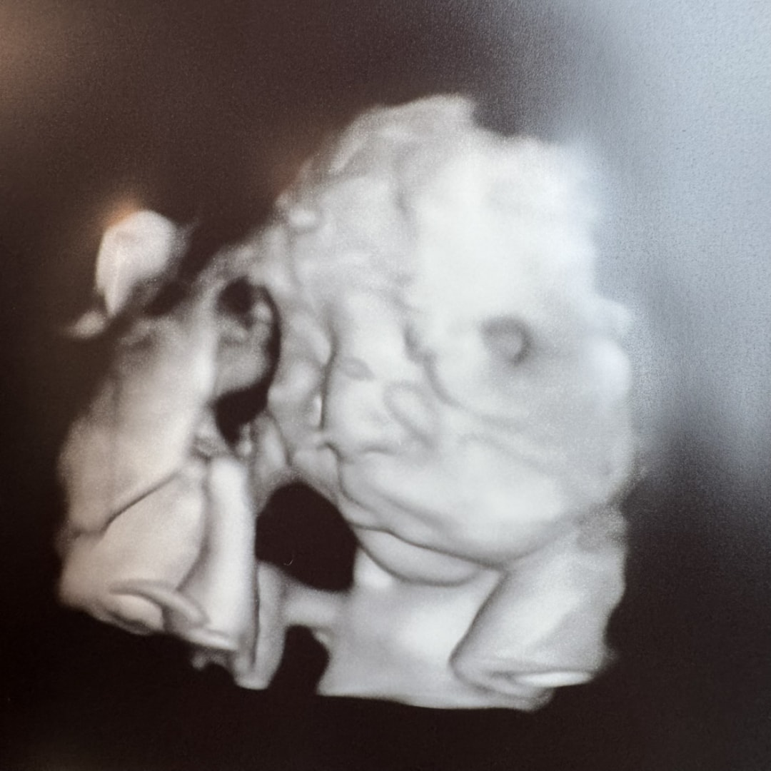 Photo shared by Brandy for their Babylist baby registry.