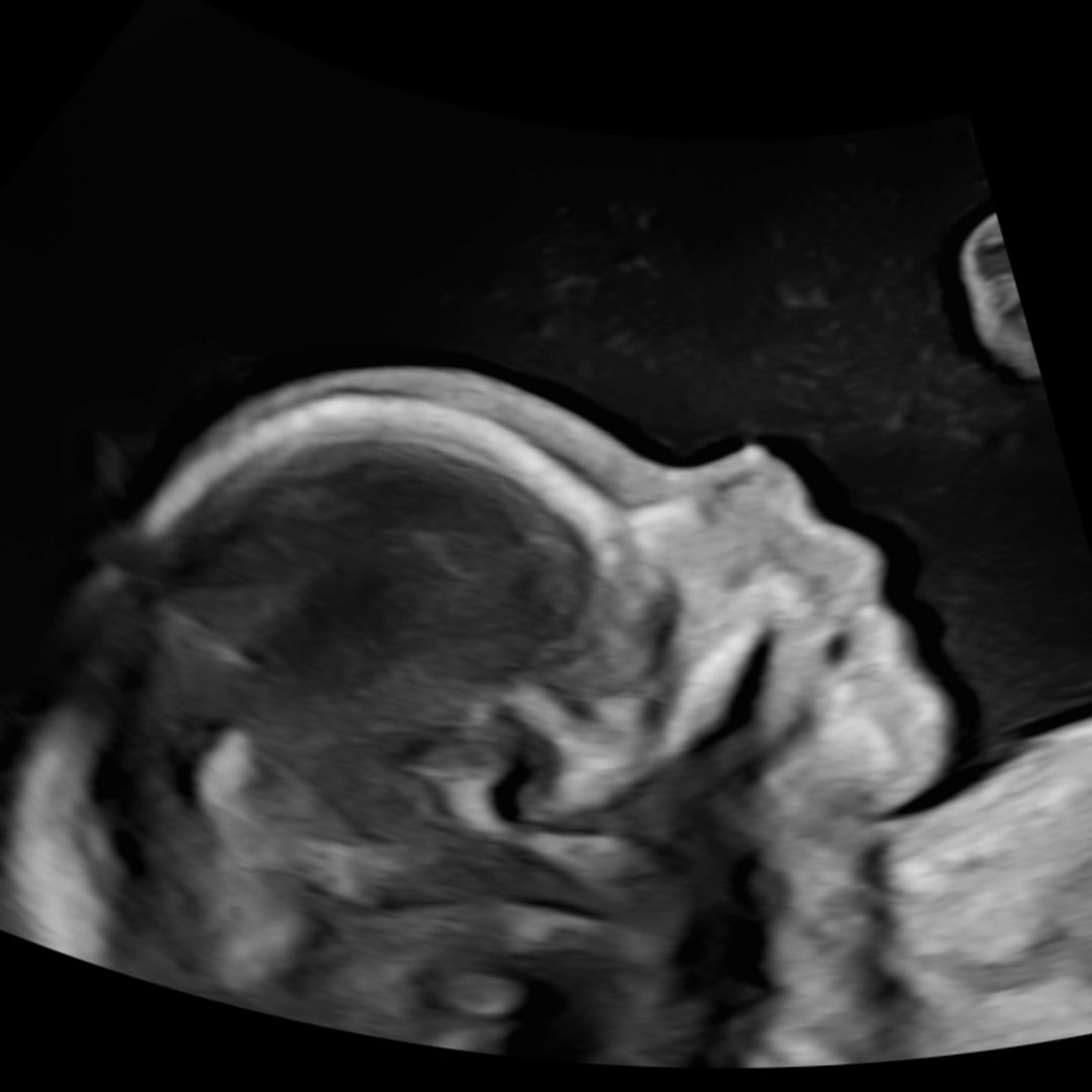 Photo shared by Madeline for their Babylist baby registry.