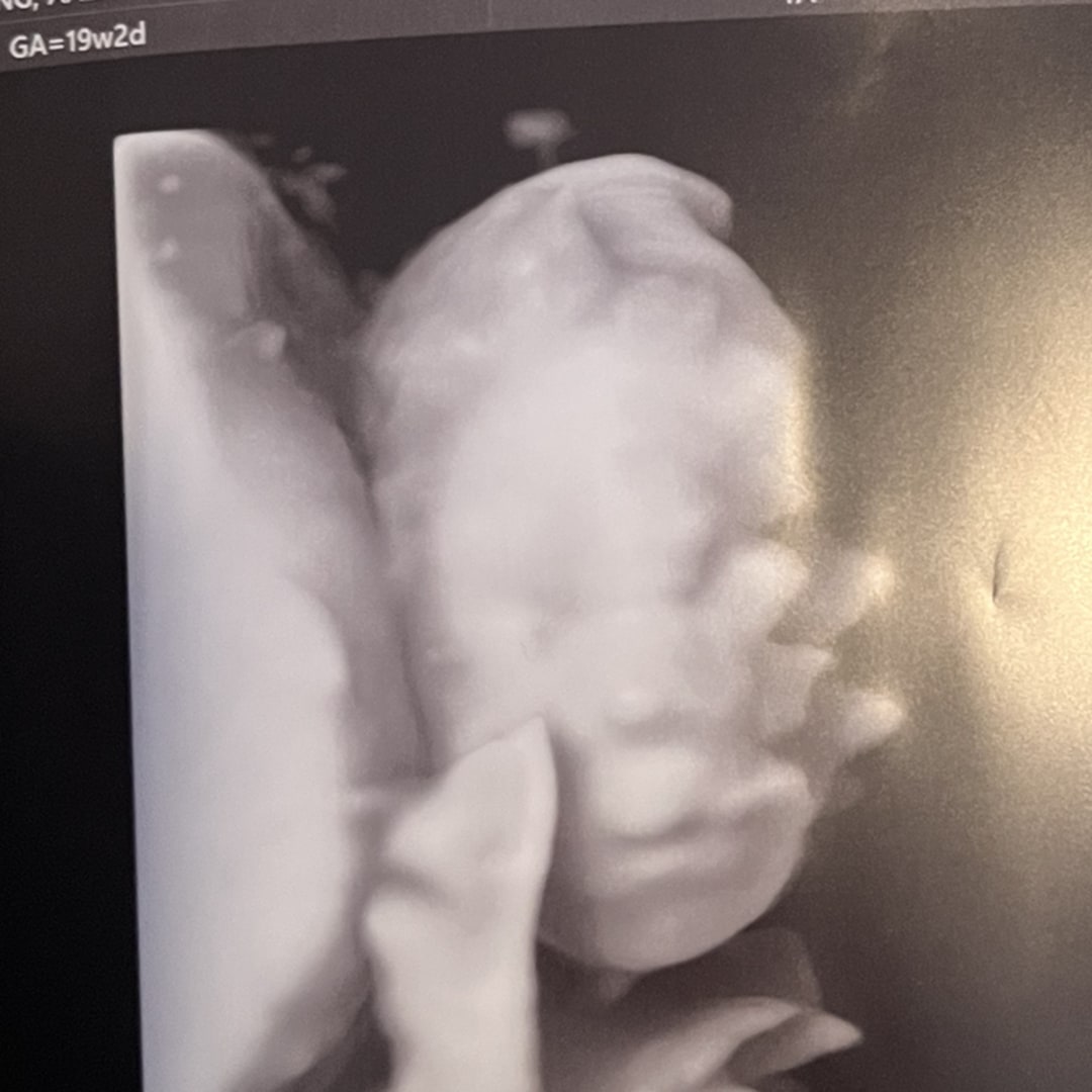 Photo shared by Aaliyah for their Babylist baby registry.