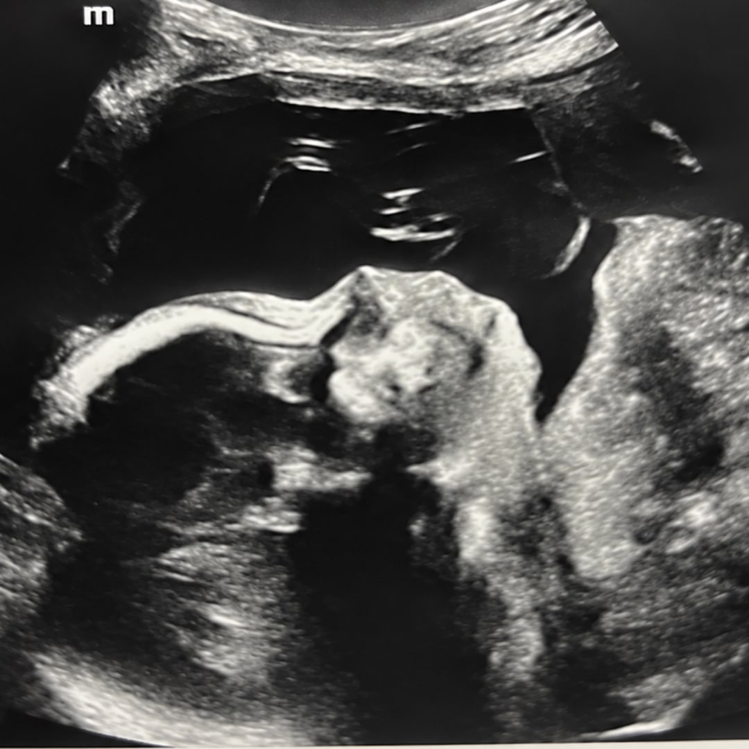 Photo shared by Ashley for their Babylist baby registry.
