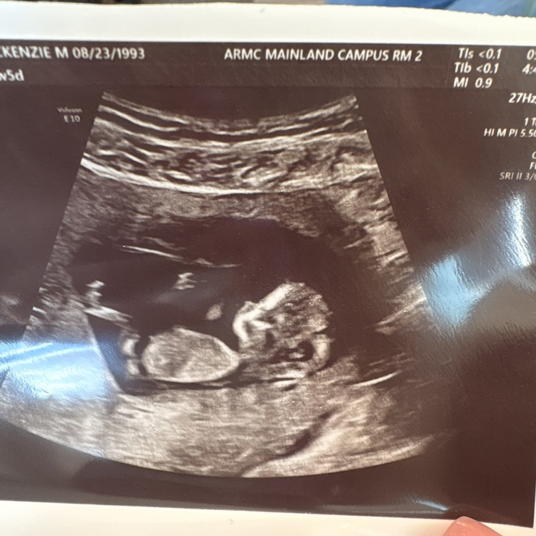 Photo shared by Mackenzie for their Babylist baby registry.