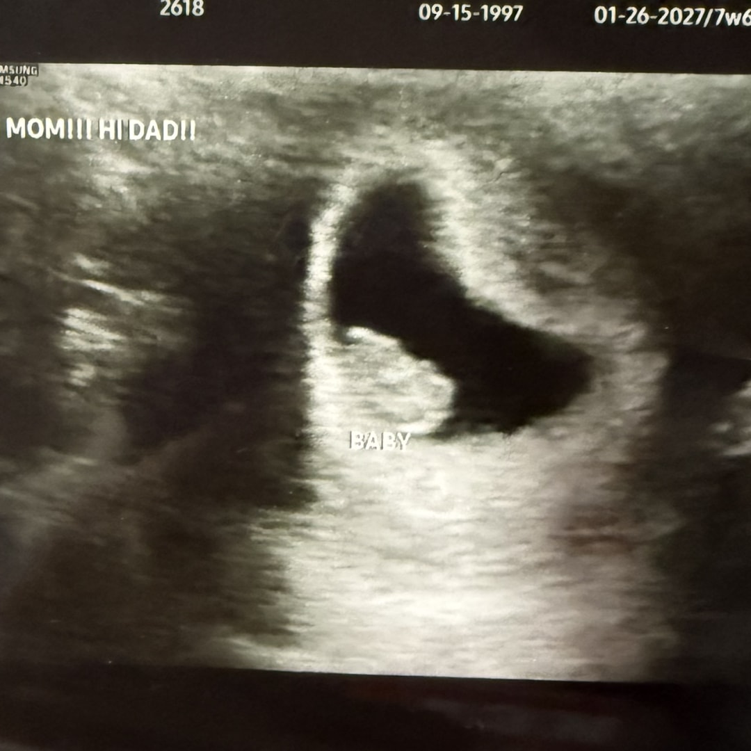 Photo shared by Erica for their Babylist baby registry.