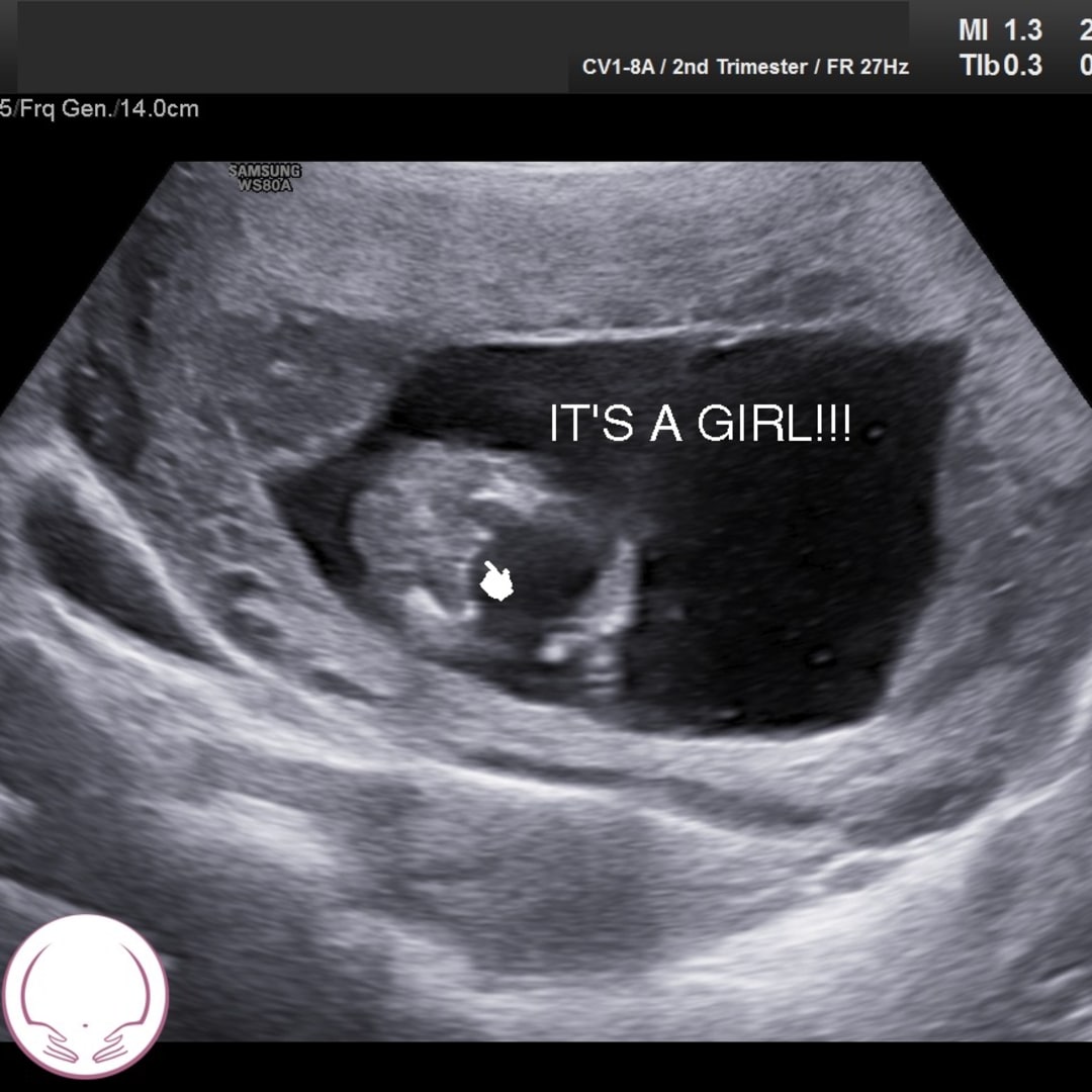 Photo shared by Brittney for their Babylist baby registry.