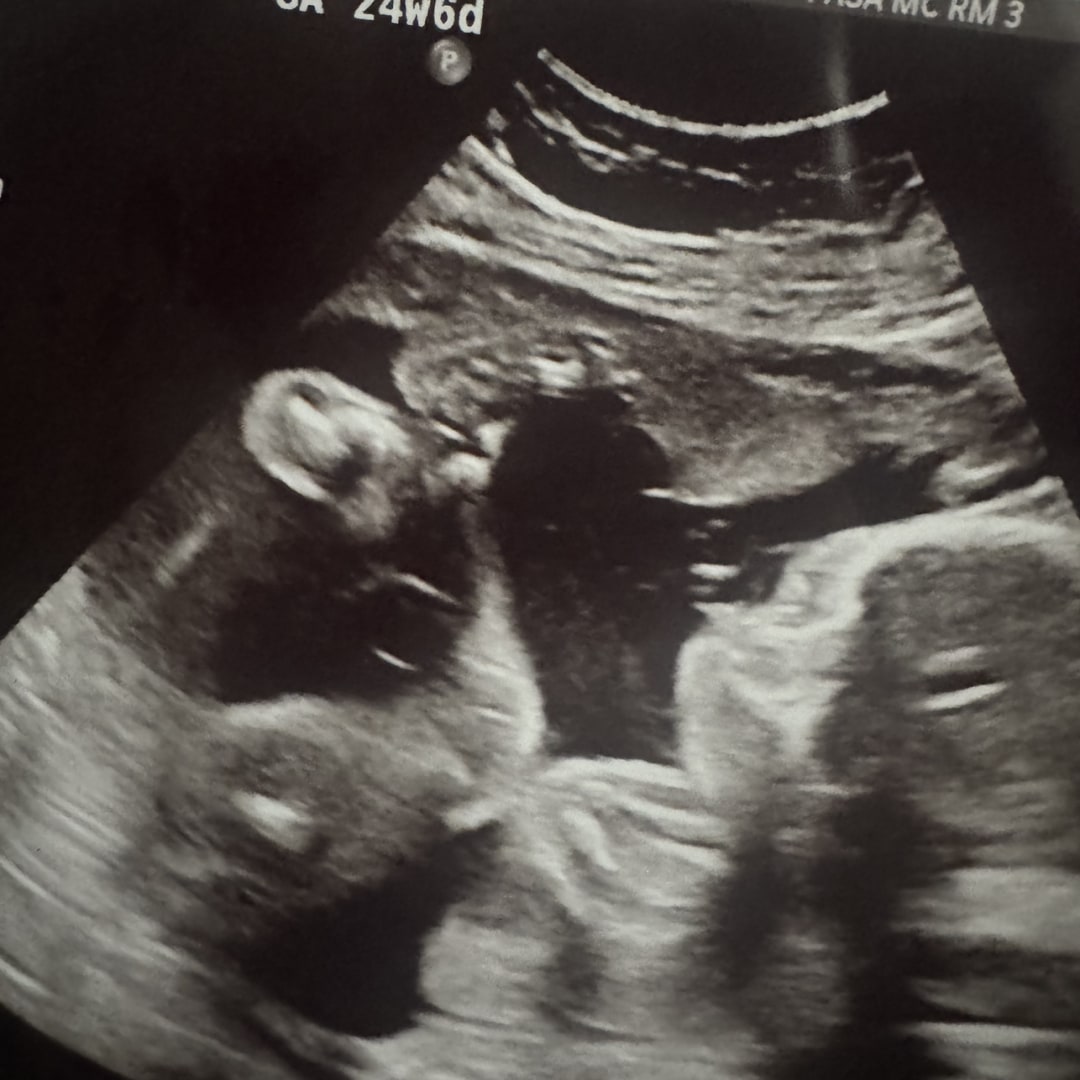 Photo shared by Mariela for their Babylist baby registry.