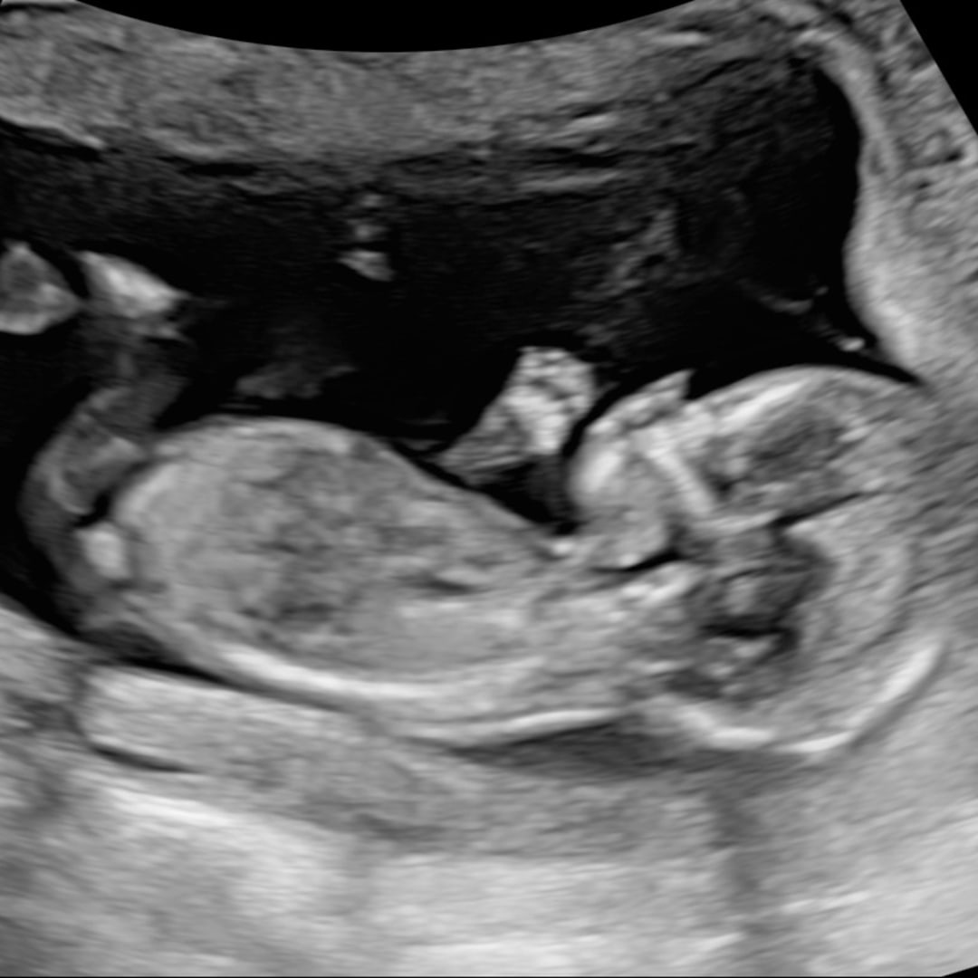 Photo shared by Gunnar for their Babylist baby registry.