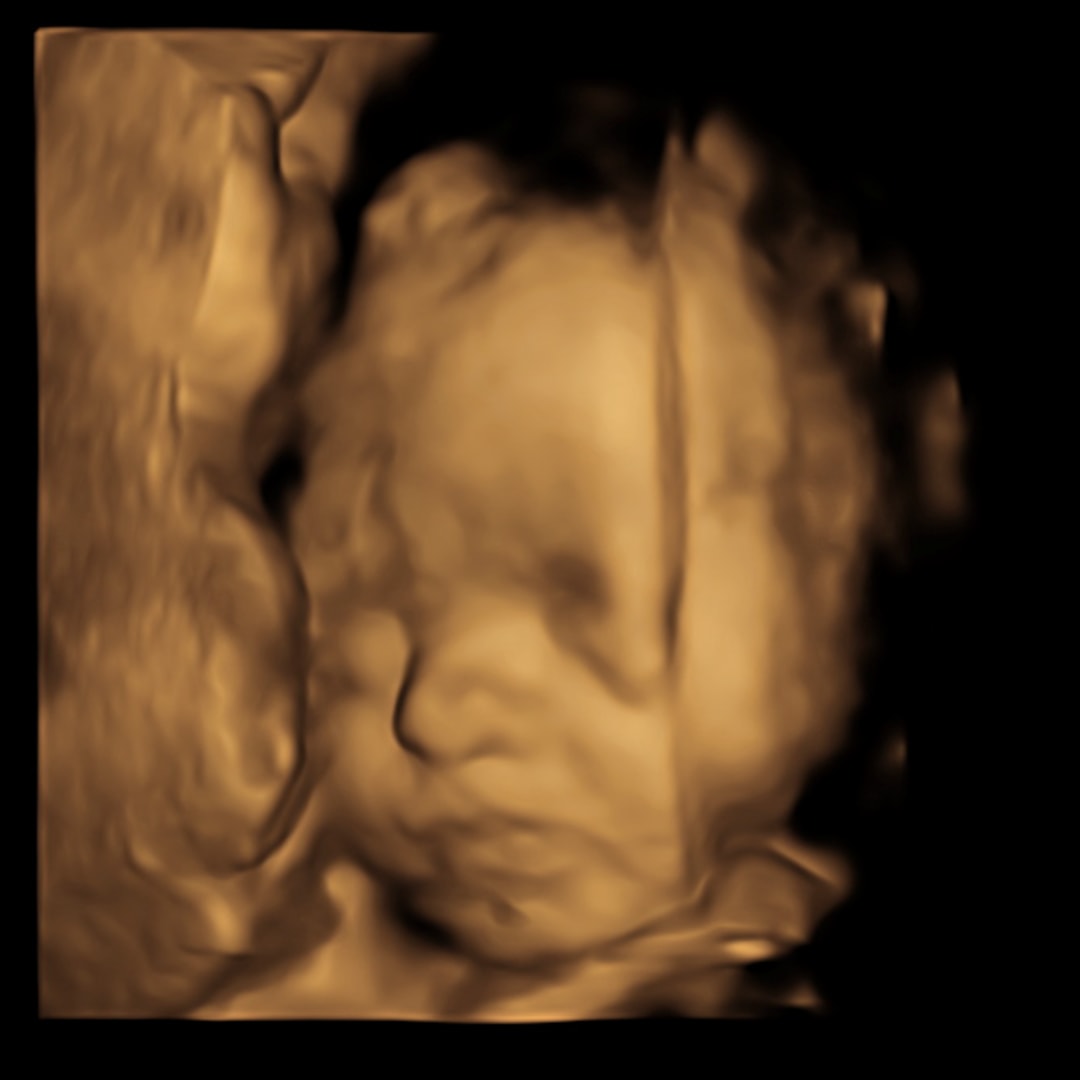 Photo shared by Allison for their Babylist baby registry.