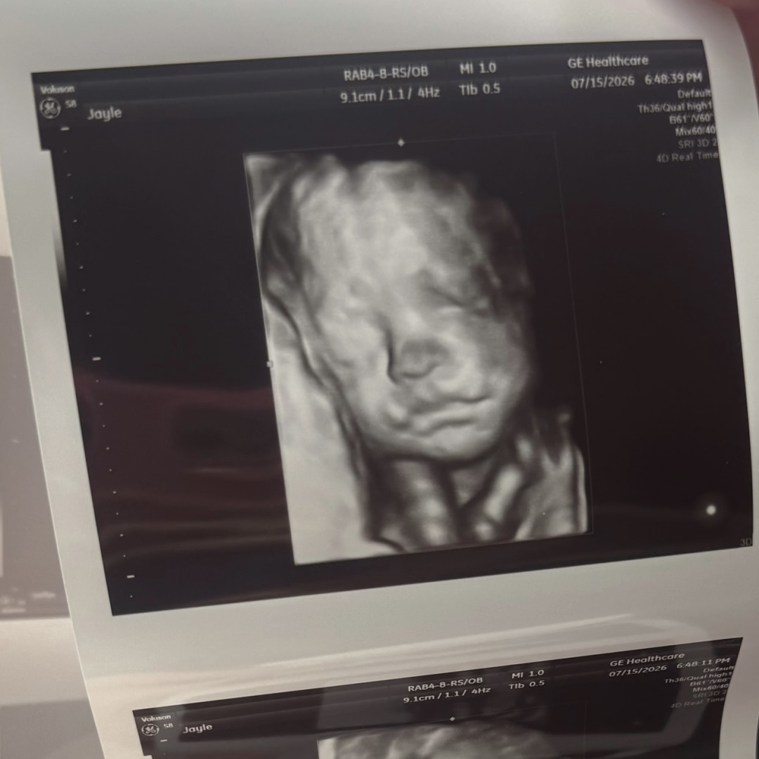 Photo shared by Jayle for their Babylist baby registry.
