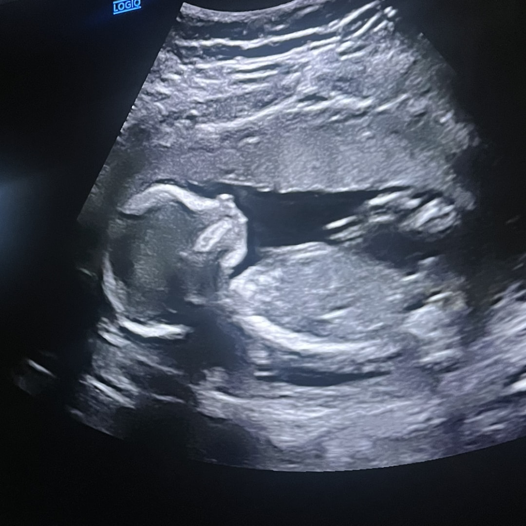 Photo shared by Aundria for their Babylist baby registry.