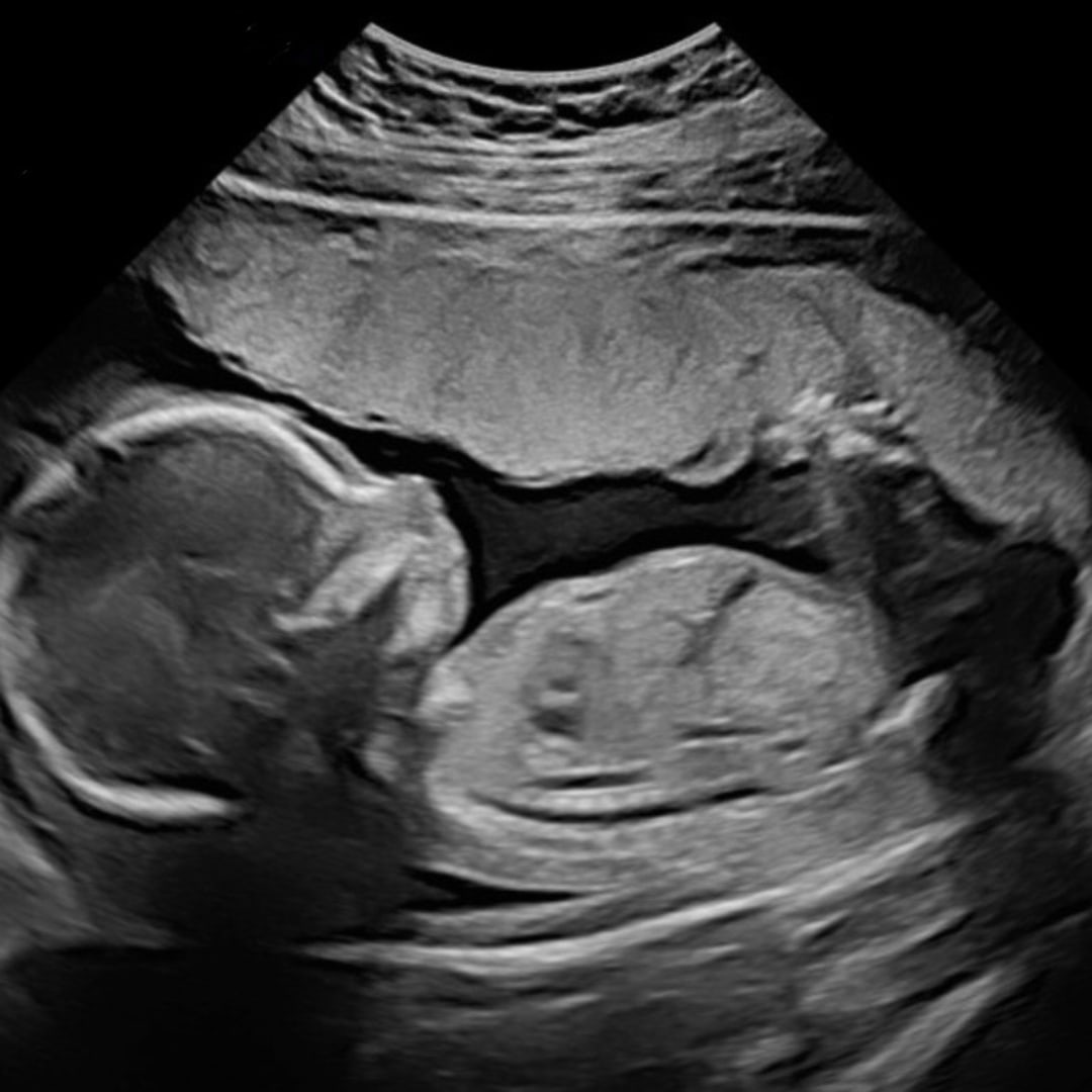 Photo shared by Angel for their Babylist baby registry.