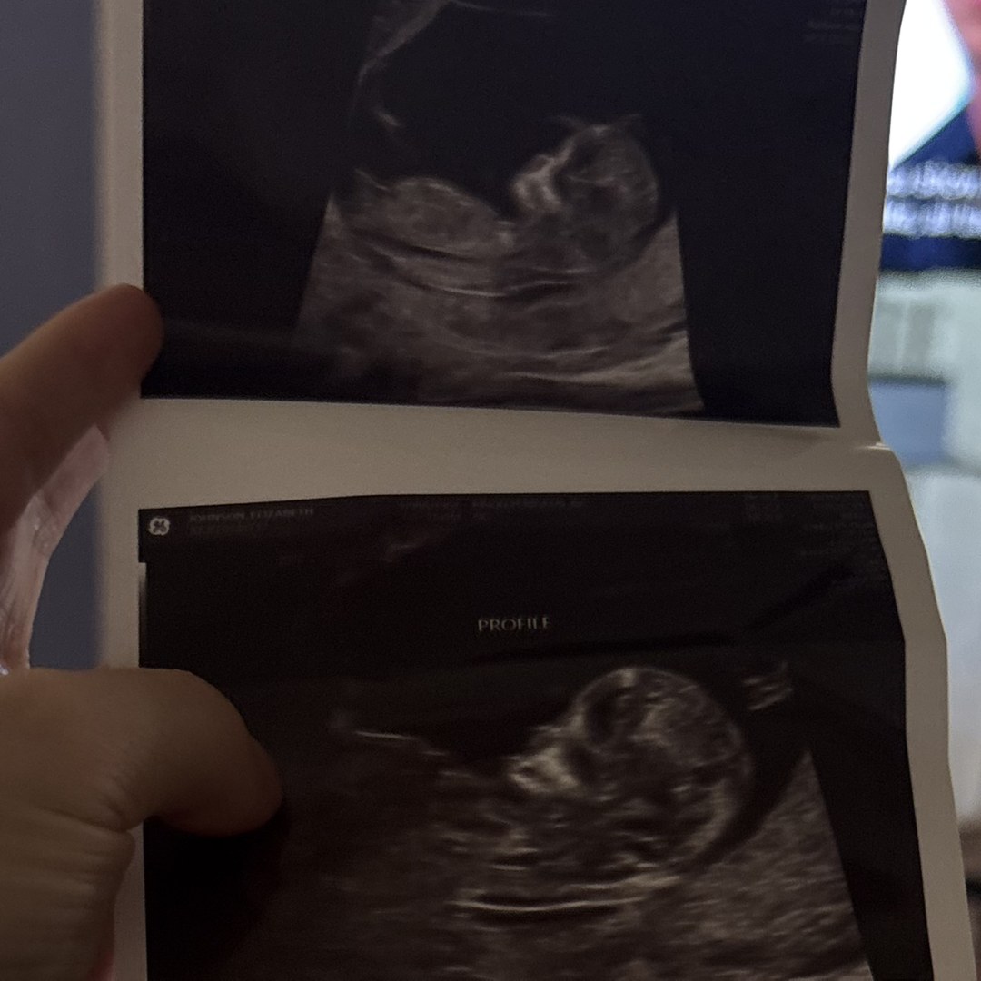 Photo shared by Ryleigh for their Babylist baby registry.