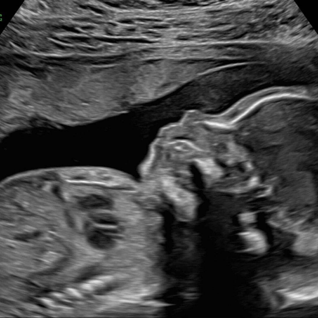 Photo shared by Sam for their Babylist baby registry.