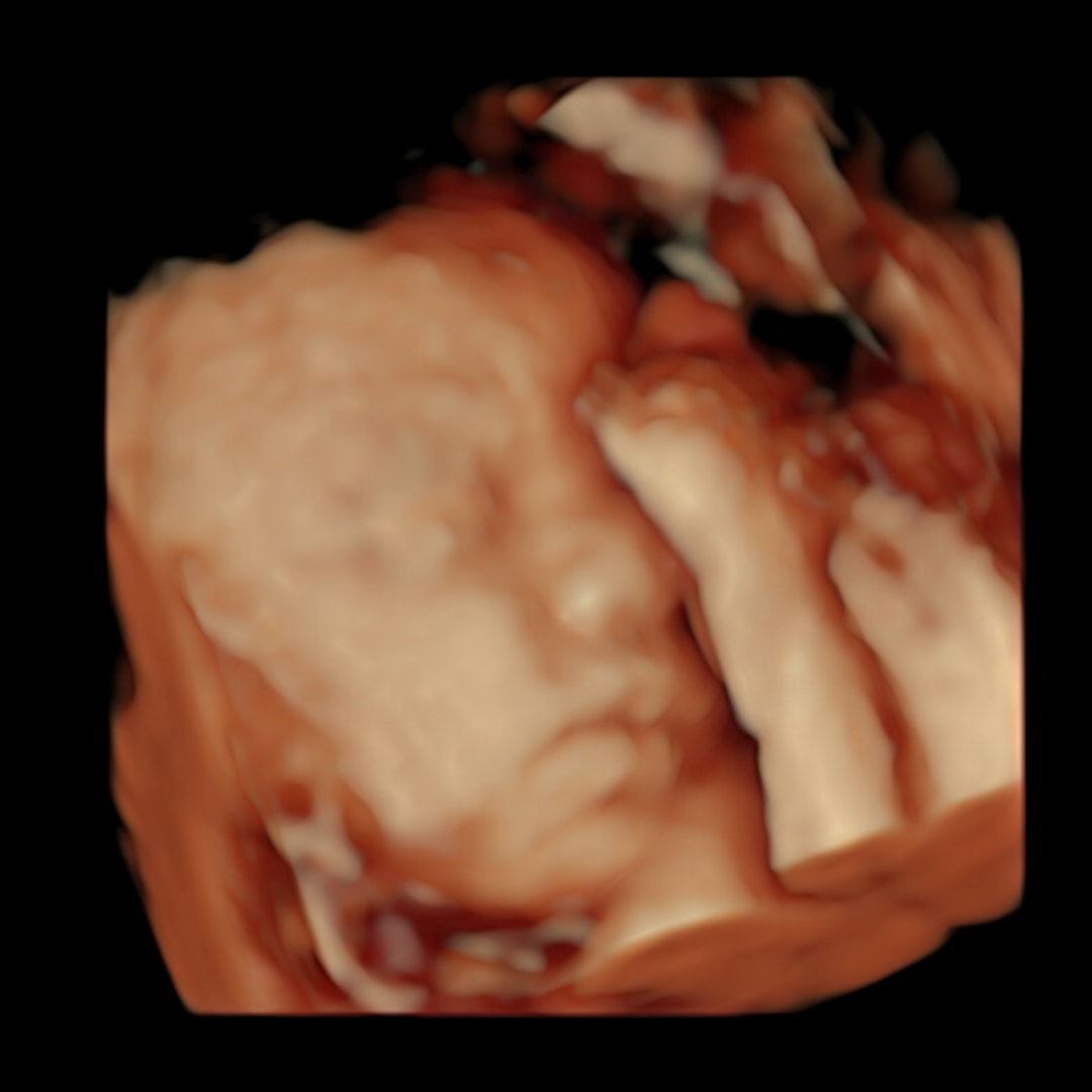 Photo shared by Adi for their Babylist baby registry.