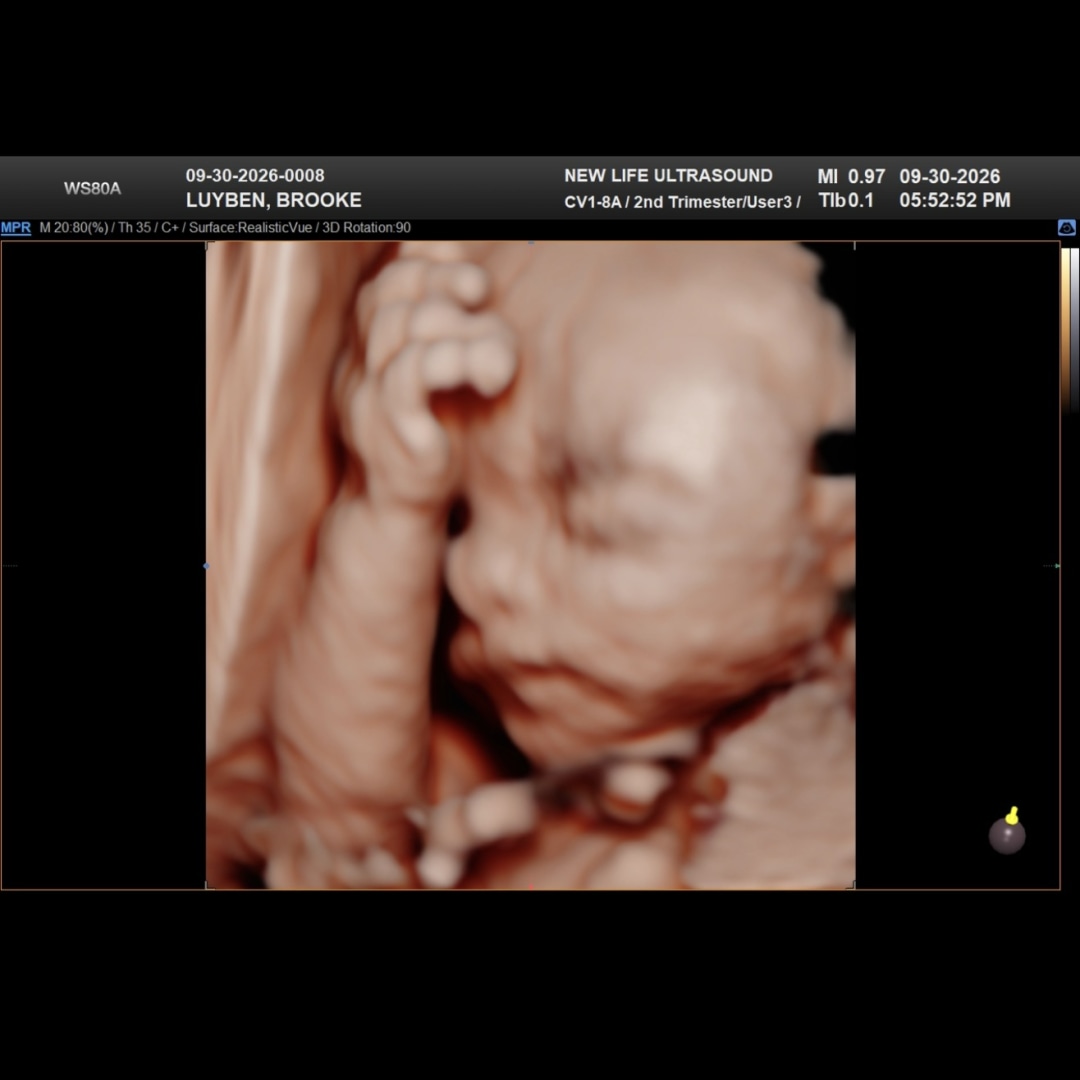 Photo shared by Brooke for their Babylist baby registry.