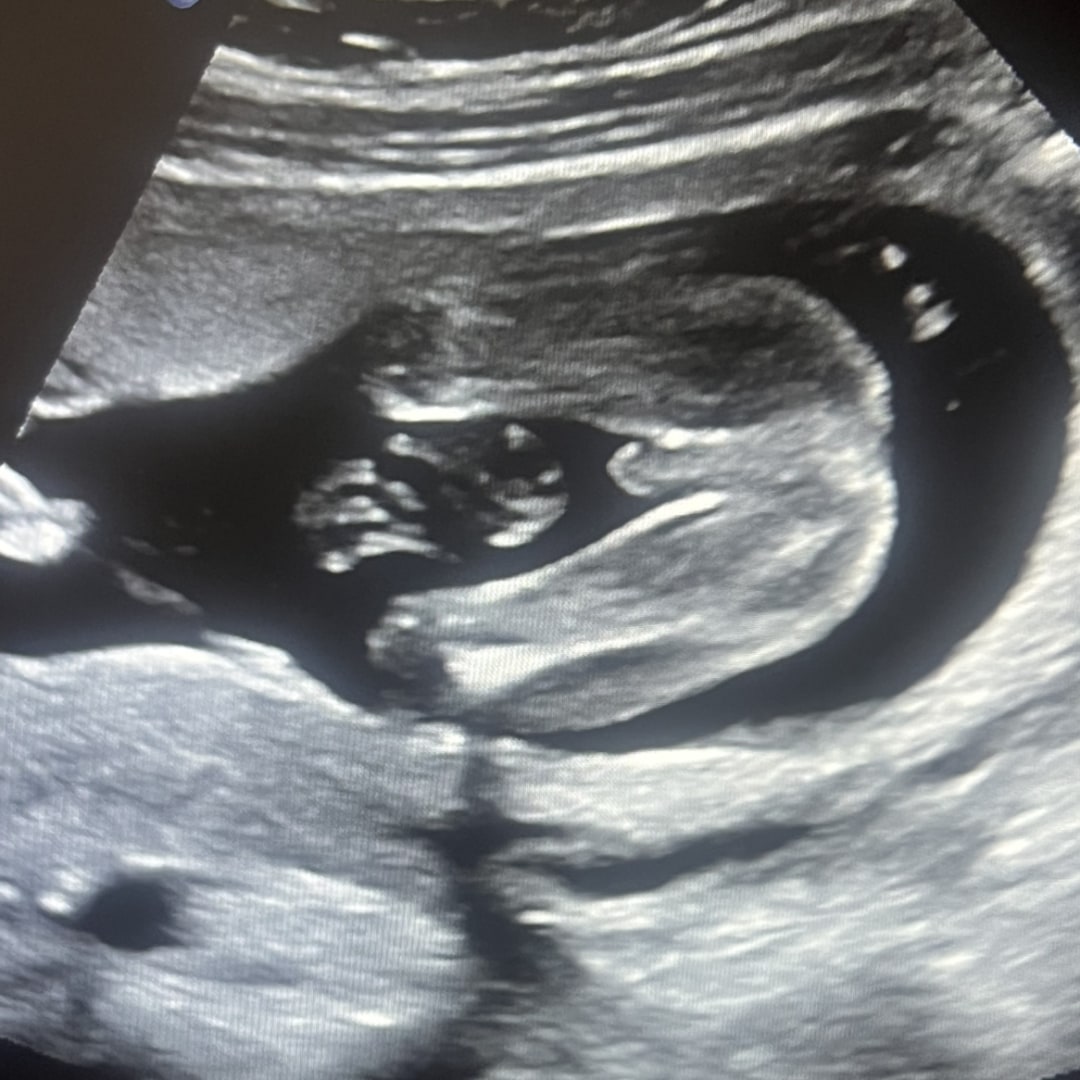 Photo shared by Jaya for their Babylist baby registry.