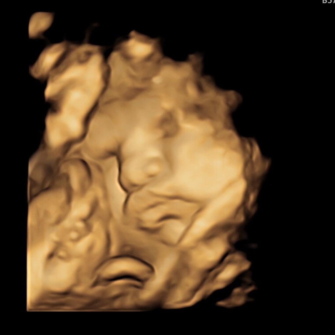 Photo shared by Caroline for their Babylist baby registry.