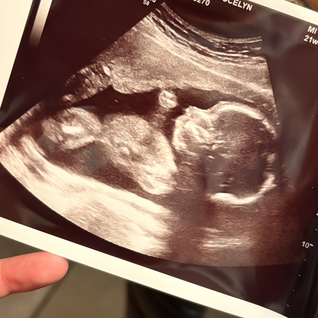 Photo shared by Jocelyn for their Babylist baby registry.