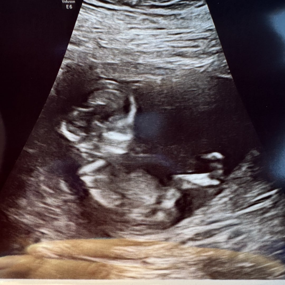 Photo shared by Valerie for their Babylist baby registry.
