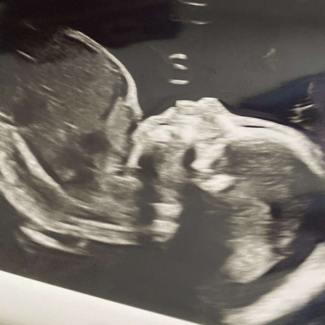 Photo shared by Emily for their Babylist baby registry.