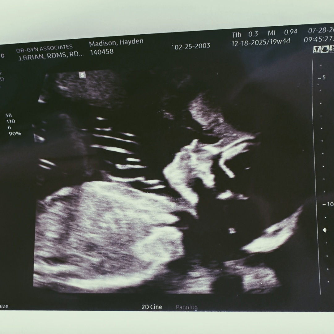 Photo shared by Hayden for their Babylist baby registry.