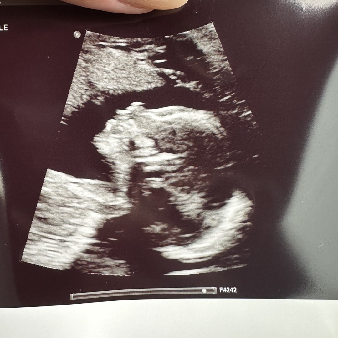 Photo shared by Amber for their Babylist baby registry.