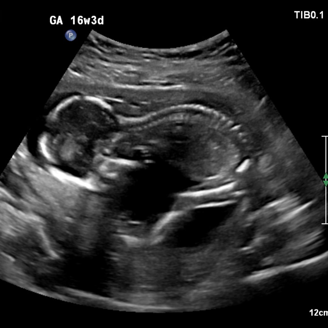 Photo shared by Ashlyn for their Babylist baby registry.