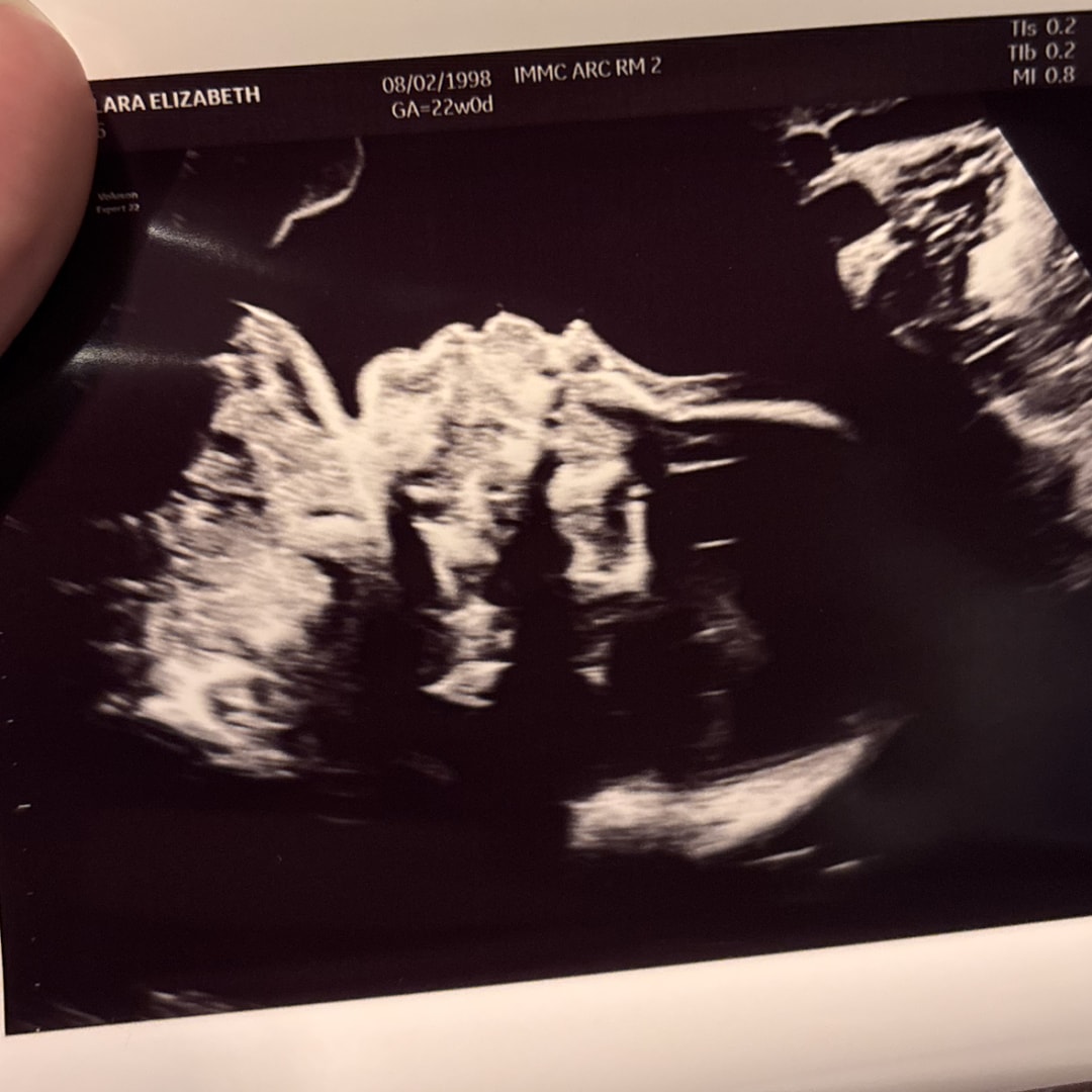 Photo shared by Clara for their Babylist baby registry.