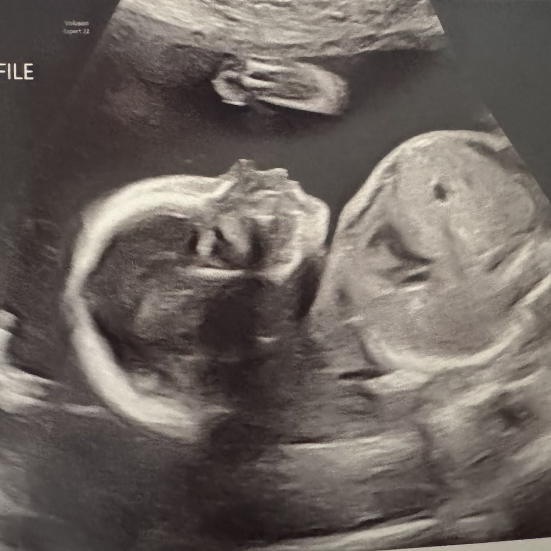 Photo shared by Kimberly for their Babylist baby registry.