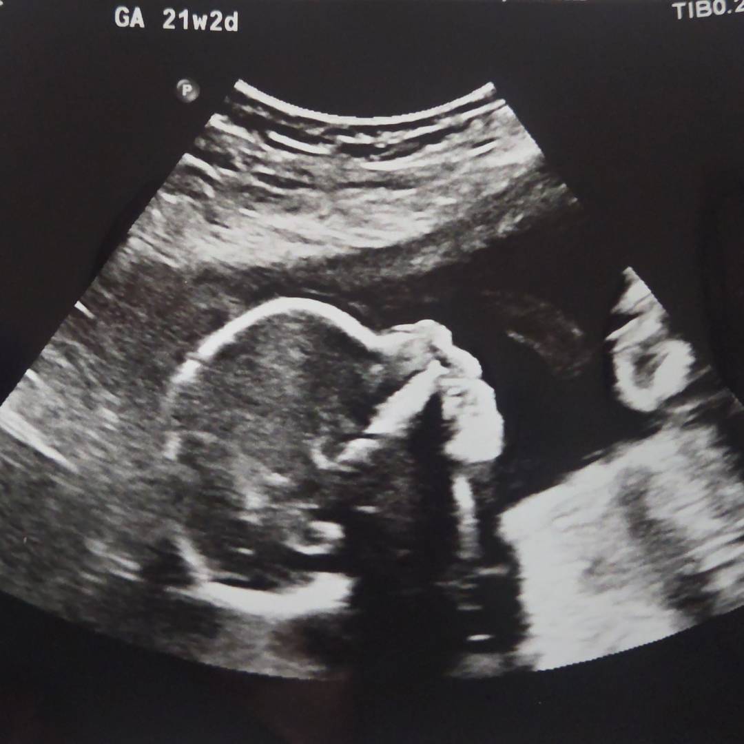 Photo shared by Jessica for their Babylist baby registry.