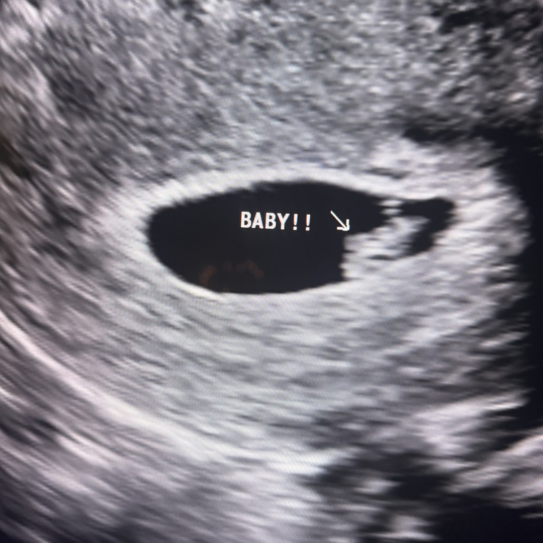 Photo shared by Jessica for their Babylist baby registry.