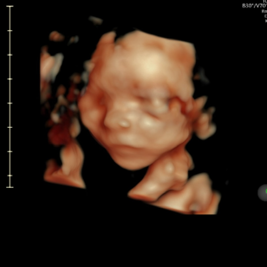 Photo shared by Larrin for their Babylist baby registry.