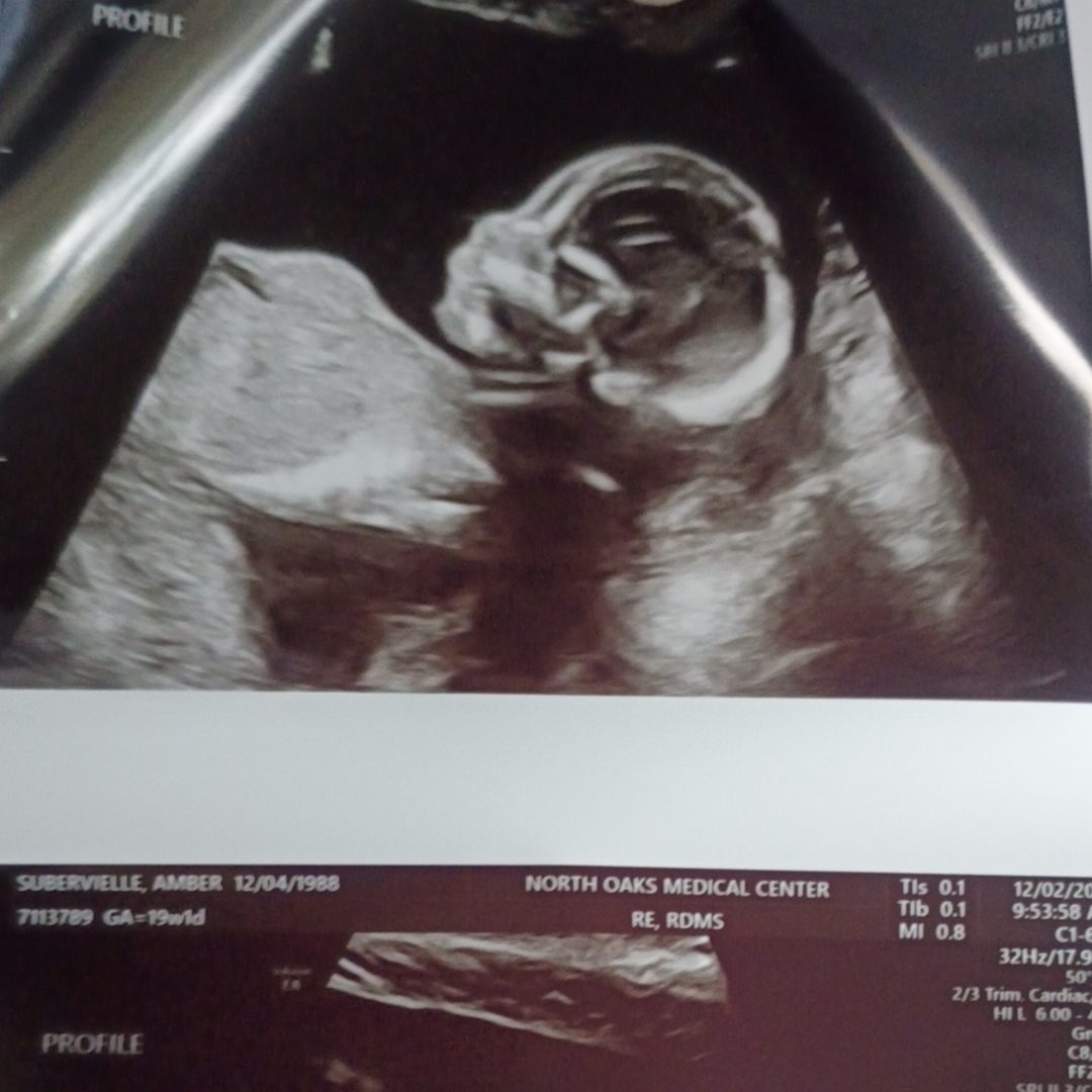 Photo shared by Amber for their Babylist baby registry.